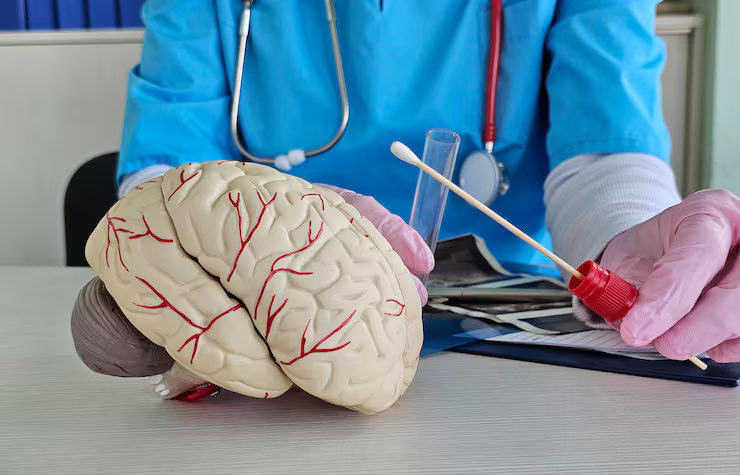 Stroke Treatment